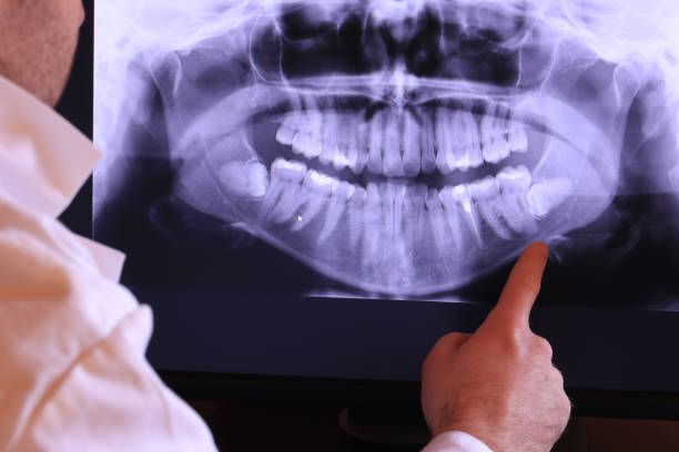Best Emergency Root Canal Treatment in Mesita, NM