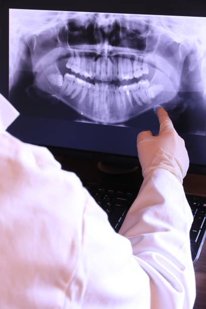 Best Emergency Broken Tooth Repair in Mesita, NM